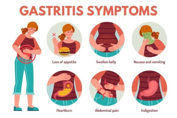 Gastritis Symptoms: Understanding the Digestive System and Its Impact