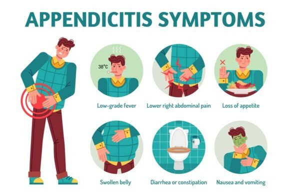 Understanding Appendicitis Symptoms: A Practical Guide